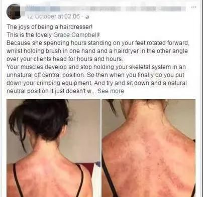英国一按摩治疗师分享刮痧心得 英国一按摩治疗师分享刮痧心得